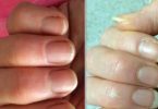 Le Remède de Grand-Mère Pour Faire Pousser Vos Ongles PLUS Vite.